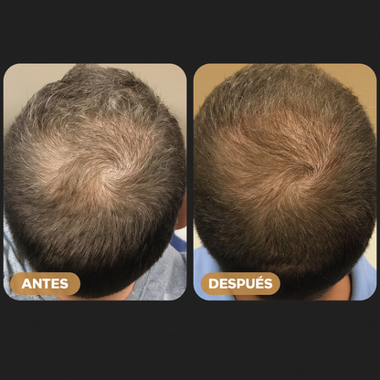 SPARTAN™ Root Activator Shampoo