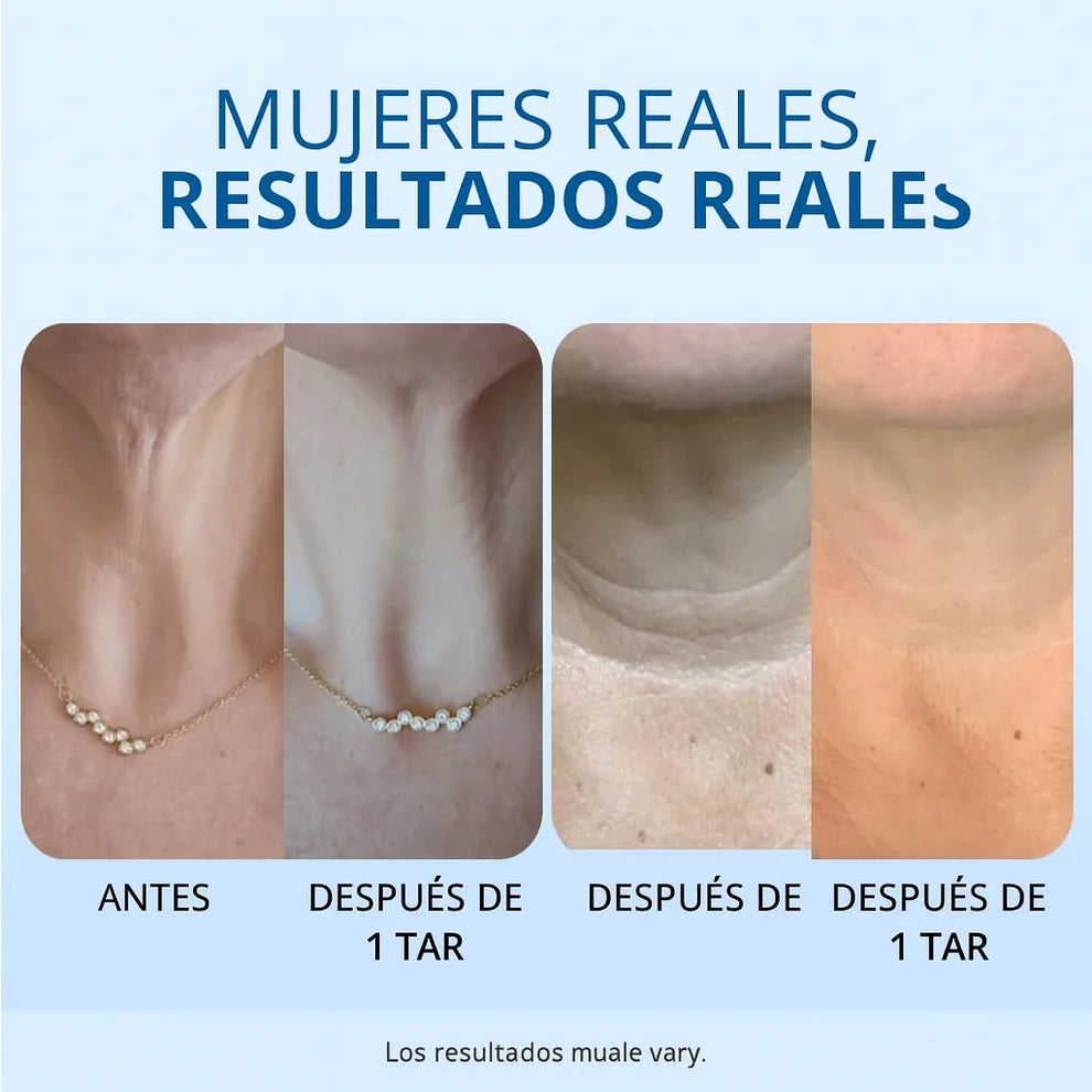 Zyrtovia™ SkinLift Cuello – Suaviza y Tensa
