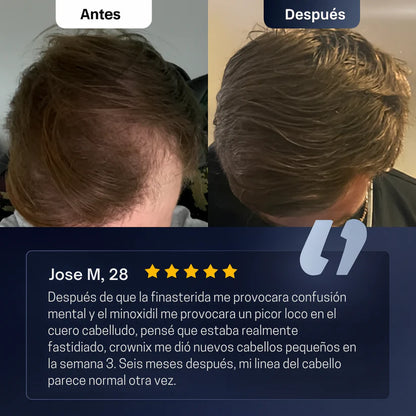 Roll-On de Crecimiento Capilar™