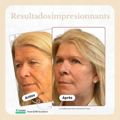 Celyana Cemenrete® -  Innovación en tu Pie