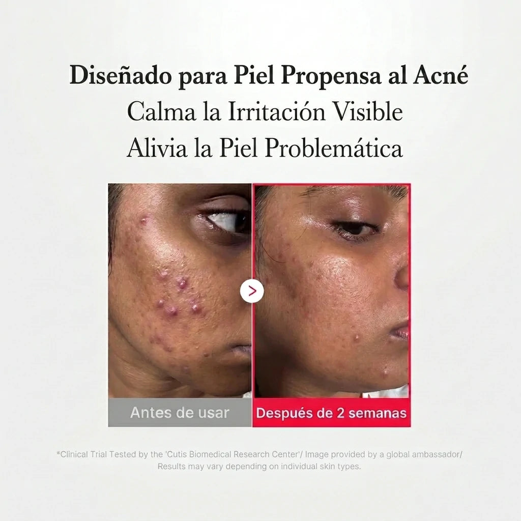 Medicube Spray: Alivio SOS y Prevención de Acné